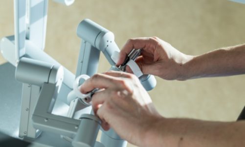 Rak nie cofa się w pandemii ? spadek profilaktyki onkologicznej i wzrost operacj