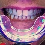 Phonebleaching – hit czy kit? Popularne wśród celebrytów i influencerów wybielanie zębów telefonem ? Co na to stomatolodzy?